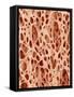 Bone tissue of a hen magnified x25-Micro Discovery-Framed Stretched Canvas