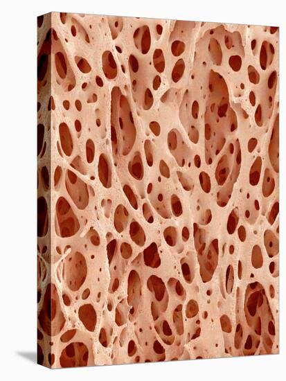 Bone tissue of a hen magnified x25-Micro Discovery-Stretched Canvas