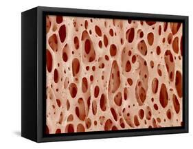 Bone tissue of a hen magnified x25-Micro Discovery-Framed Stretched Canvas