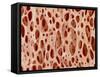 Bone tissue of a hen magnified x25-Micro Discovery-Framed Stretched Canvas