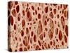 Bone tissue of a hen magnified x25-Micro Discovery-Stretched Canvas