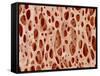 Bone tissue of a hen magnified x25-Micro Discovery-Framed Stretched Canvas