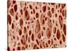 Bone tissue of a hen magnified x25-Micro Discovery-Stretched Canvas