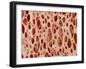 Bone tissue of a hen magnified x25-Micro Discovery-Framed Premium Photographic Print