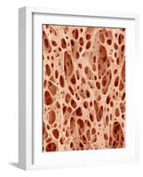 Bone tissue of a hen magnified x25-Micro Discovery-Framed Photographic Print