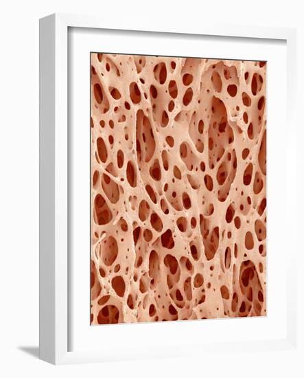 Bone tissue of a hen magnified x25-Micro Discovery-Framed Photographic Print