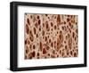 Bone tissue of a hen magnified x25-Micro Discovery-Framed Photographic Print