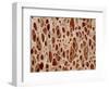 Bone tissue of a hen magnified x25-Micro Discovery-Framed Photographic Print