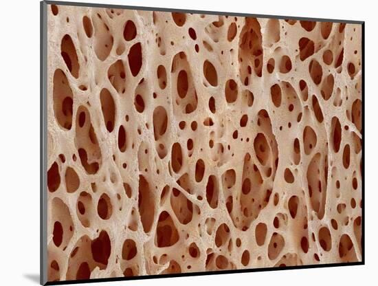 Bone tissue of a hen magnified x25-Micro Discovery-Mounted Photographic Print