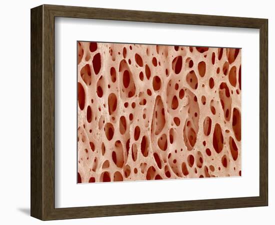 Bone tissue of a hen magnified x25-Micro Discovery-Framed Photographic Print