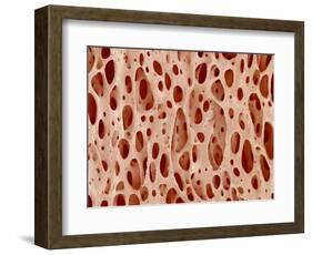 Bone tissue of a hen magnified x25-Micro Discovery-Framed Photographic Print