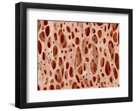 Bone tissue of a hen magnified x25-Micro Discovery-Framed Photographic Print