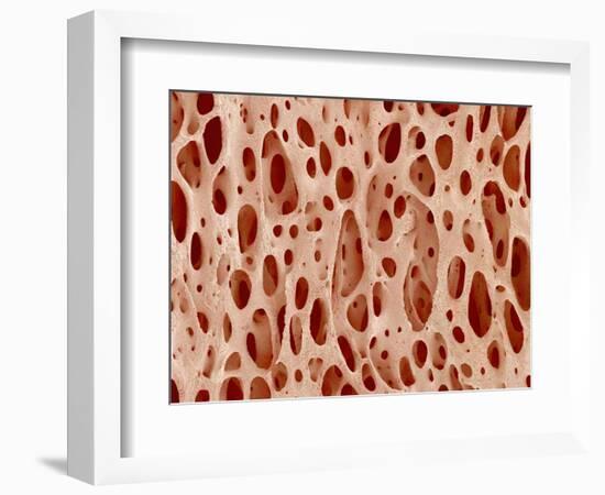 Bone tissue of a hen magnified x25-Micro Discovery-Framed Photographic Print