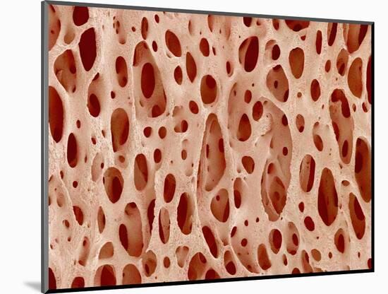 Bone tissue of a hen magnified x25-Micro Discovery-Mounted Photographic Print