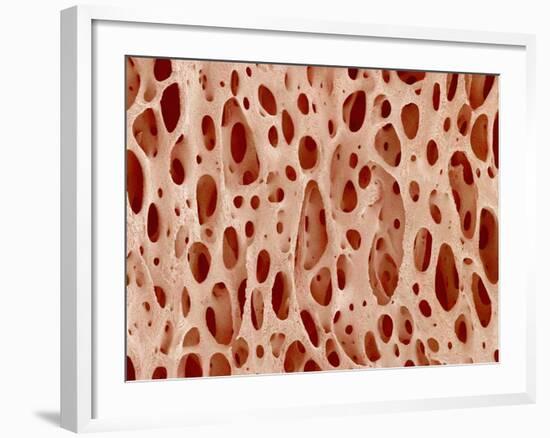 Bone tissue of a hen magnified x25-Micro Discovery-Framed Photographic Print