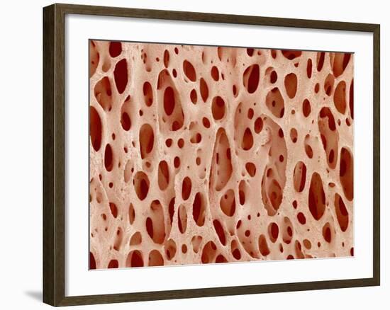 Bone tissue of a hen magnified x25-Micro Discovery-Framed Photographic Print