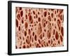 Bone tissue of a hen magnified x25-Micro Discovery-Framed Photographic Print