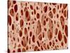 Bone tissue of a hen magnified x25-Micro Discovery-Stretched Canvas