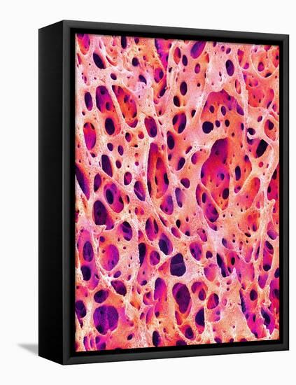 Bone Tissue of Chicken-Micro Discovery-Framed Stretched Canvas