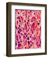 Bone Tissue of Chicken-Micro Discovery-Framed Photographic Print