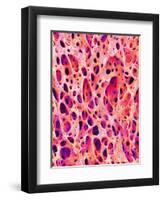 Bone Tissue of Chicken-Micro Discovery-Framed Photographic Print