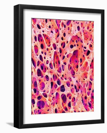 Bone Tissue of Chicken-Micro Discovery-Framed Photographic Print