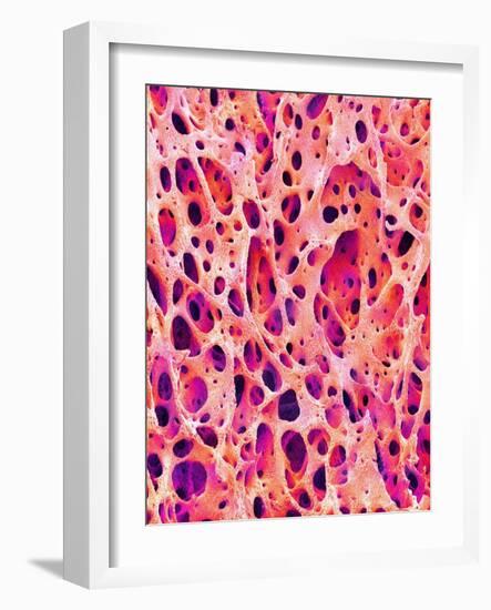 Bone Tissue of Chicken-Micro Discovery-Framed Photographic Print