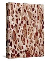 Bone Tissue-Micro Discovery-Stretched Canvas