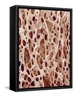 Bone Tissue-Micro Discovery-Framed Stretched Canvas