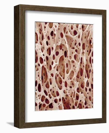 Bone Tissue-Micro Discovery-Framed Photographic Print