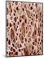 Bone Tissue-Micro Discovery-Mounted Photographic Print