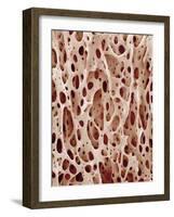 Bone Tissue-Micro Discovery-Framed Photographic Print
