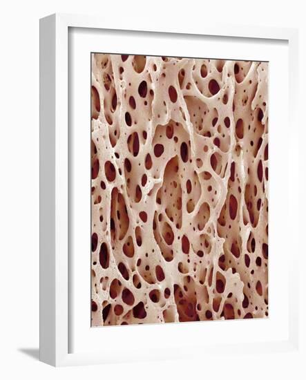 Bone Tissue-Micro Discovery-Framed Photographic Print