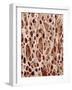 Bone Tissue-Micro Discovery-Framed Photographic Print