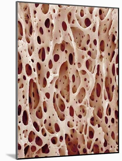 Bone Tissue-Micro Discovery-Mounted Photographic Print