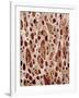 Bone Tissue-Micro Discovery-Framed Photographic Print