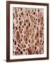 Bone Tissue-Micro Discovery-Framed Photographic Print