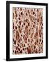 Bone Tissue-Micro Discovery-Framed Photographic Print