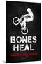 Bones Heal Chicks Dig Scars BMX Sports-null-Mounted Art Print