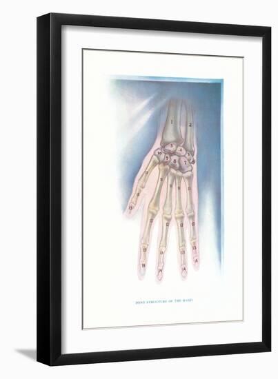 Bones of the Hand-Found Image Press-Framed Giclee Print