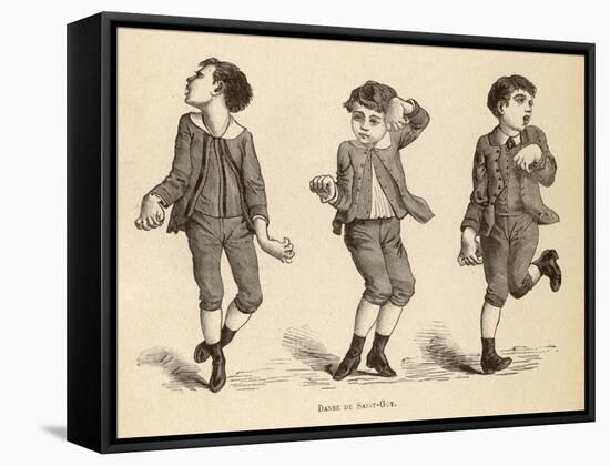Boys Afflicted with Chorea Known as St. Vitus' Dance or as Danse de Saint-Guy in France-null-Framed Stretched Canvas