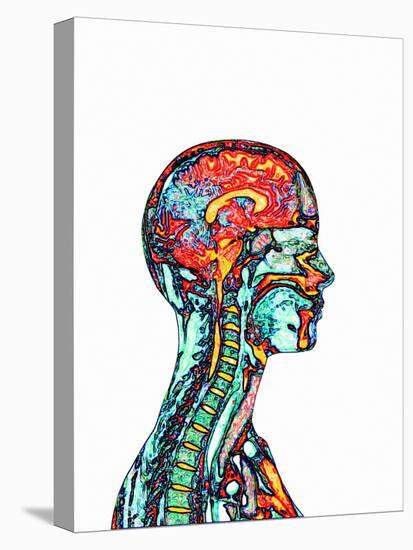 Brain And Spinal Cord, MRI-Mehau Kulyk-Stretched Canvas