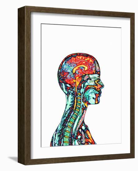 Brain And Spinal Cord, MRI-Mehau Kulyk-Framed Photographic Print