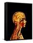 Brain And Spinal Cord-Mehau Kulyk-Framed Stretched Canvas