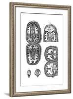 Brain Cavities 18th C.-null-Framed Giclee Print