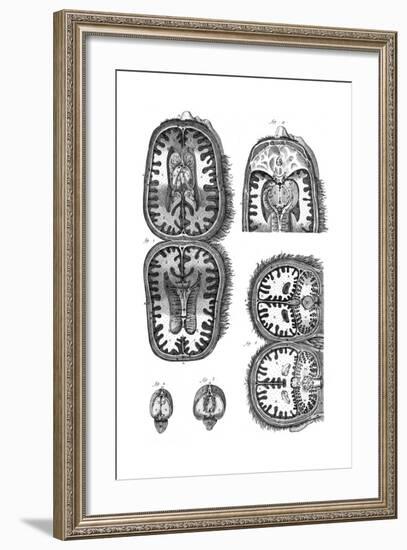 Brain Cavities 18th C.-null-Framed Giclee Print