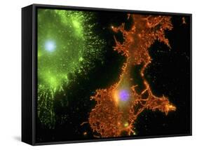 Brain Cells In Culture, Light Micrograph-Riccardo Cassiani-ingoni-Framed Stretched Canvas