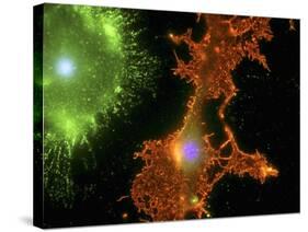 Brain Cells In Culture, Light Micrograph-Riccardo Cassiani-ingoni-Stretched Canvas