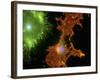 Brain Cells In Culture, Light Micrograph-Riccardo Cassiani-ingoni-Framed Photographic Print