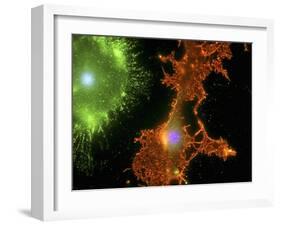 Brain Cells In Culture, Light Micrograph-Riccardo Cassiani-ingoni-Framed Photographic Print